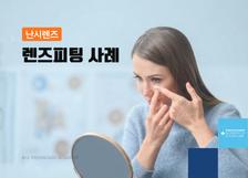 난시렌즈